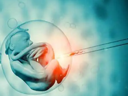 25岁做婴儿试管能成功吗