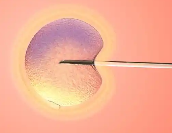 25岁做试管婴儿几率有多大