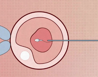 24岁试管成功率有多大